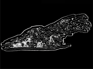 Magnesium deficiency: is your magnesium missing in action?